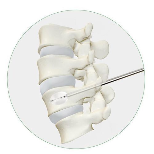 Инструмент для вертебропластики балонный катетер - Princeton Medical Scientific - для чрескожной кифопластики