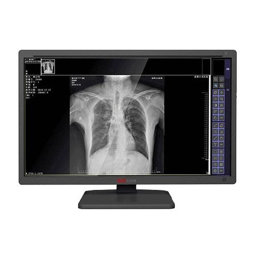 Медицинский монитор - MDS-C series - Shenzhen Juding Medical Equipment Co.,Ltd. - для диагностики / для медицинских снимков / для рентгенологии
