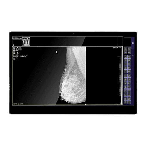 Медицинский монитор - IVS-8MP - Shenzhen Juding Medical Equipment Co.,Ltd. - для диагностики / для медицинских снимков / маммографический