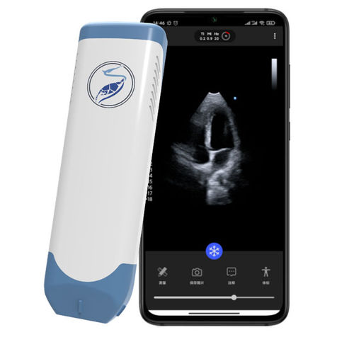 Портативный ультразвуковой сканер - Lite31P - Beijing iTrason Technologies - для сердечно-сосудистой эхографии / черно-белый / спектральный допплер