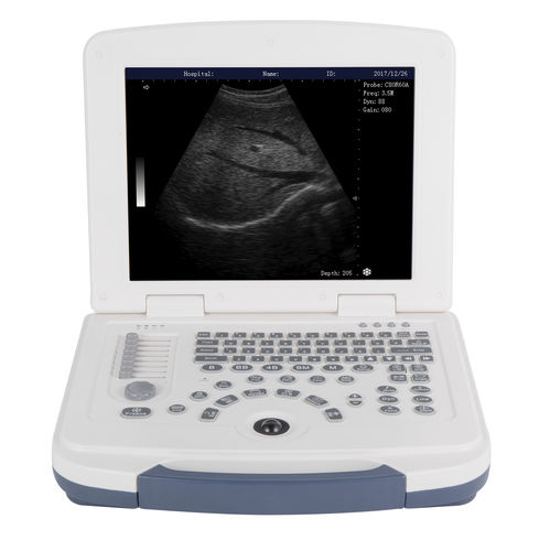 Черно-белый ультразвуковой сканер - DW-580 - Dawei Medical - переносной / для поливалентной эхографии / со встроенной консолью