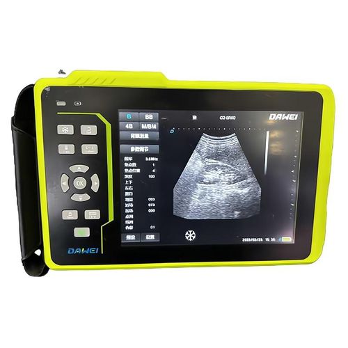 Портативный ветеринарный ультразвуковой сканер - Y6 - Dawei Medical - многоцелевой / для небольших животных / для крупных животных