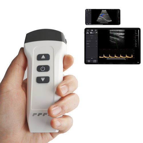 Портативный ультразвуковой сканер - DW-X1 - Dawei Medical - для эхографии в акушерстве и гинекологии / для брюшной и тазовой эхографии / для костно-мышечной эхографии