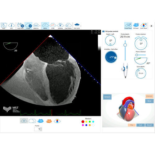 Испытательное программное обеспечение - eTEEmothy - Medical Simulation Technologies - учебное / для медицинской симуляции / медицинское
