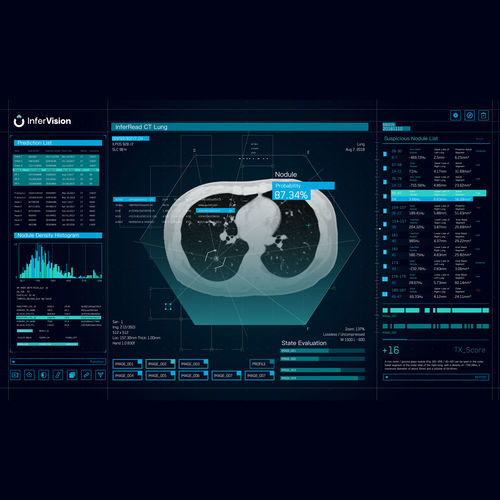Программное обеспечение для анализа - Beijing Infervision Technology Co. Ltd. - для составления отчетности / для обработки / для утверждения