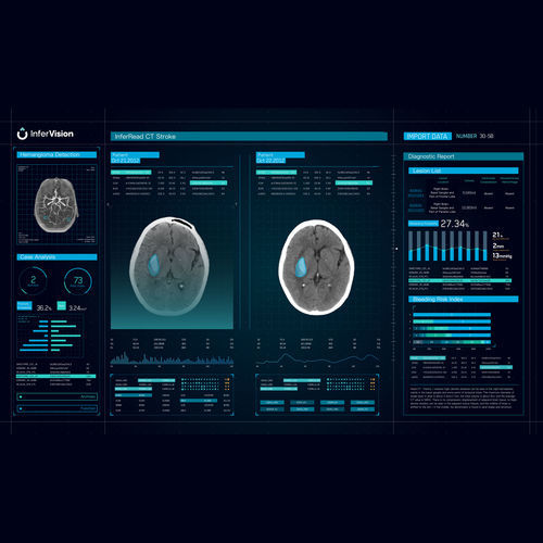 Программное обеспечение управления аварийными сигналами - CT Stroke - Beijing Infervision Technology Co. Ltd. - для обработки / для идентификации штаммов / медицинское