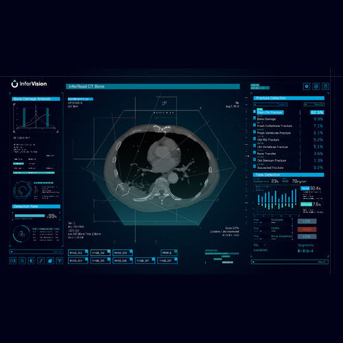 Программное обеспечение для анализа - Bone - Beijing Infervision Technology Co. Ltd. - для анализа изображений / для диагностики / медицинское