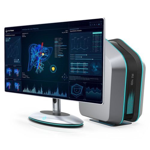 Медицинское программное обеспечение - InferOperate® Suite  - Beijing Infervision Technology Co. Ltd. - хирургическое / клиническое / для визуализации