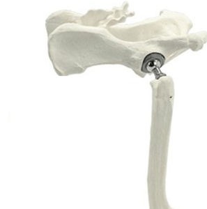 Протез тазобедренного сустава для животных с цементом - THR - Anhui Bailu Small Animal Orthopedic Instrument - полная пластика тазобедренного сустава