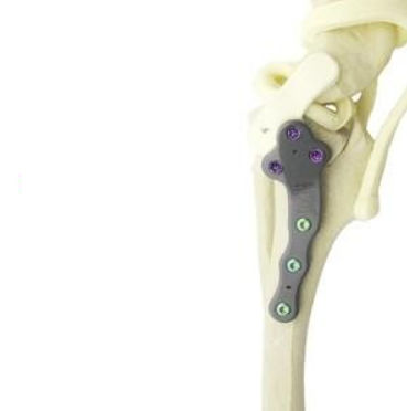 Сжимающая костная пластина для животных для лап - TPLO - Anhui Bailu Small Animal Orthopedic Instrument