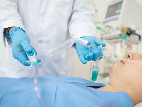 Система аспирации для эндотрахеальной интубации - H206400 - Ningbo Xinwell Medical Technology - для трахеотомии