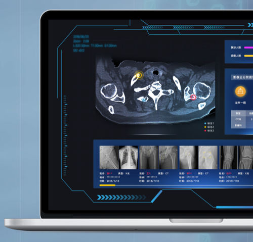 PACS с облачной обработкой данных - NovaCloud® - Huiying Medical Technology (Beijing) Co., Ltd. - медицинская