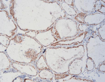 Реактив ткани - FCM0080 - Celnovte Biotechnology Co., Ltd. - для иммуногистохимии / на гликопротеины