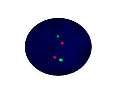Набор для теста на брюшной тиф - CF1003 - Celnovte Biotechnology Co., Ltd. - для исследований / на раковые опухоли / для онкологии