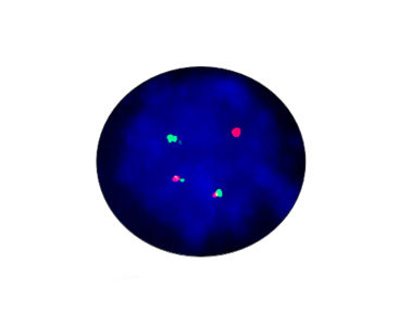 Набор для теста ген слияния EML4-ALK - CF1012 - Celnovte Biotechnology Co., Ltd. - на брюшной тиф / для исследований / на рак легких