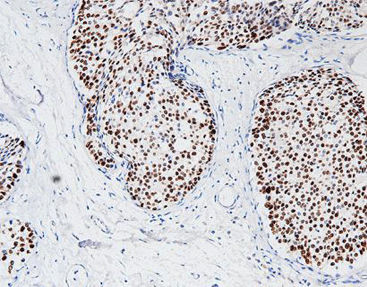Реактив моноклональное антитело - CPM-0365 - Celnovte Biotechnology Co., Ltd. - поликлональное антитело / для исследований / ткани