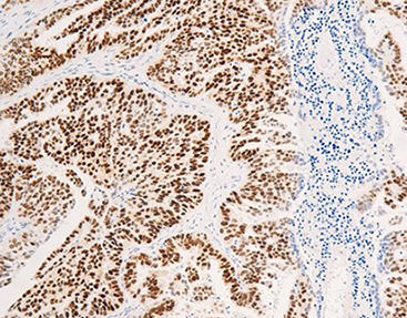 Реактив моноклональное антитело - CEM-0081 - Celnovte Biotechnology Co., Ltd. - поликлональное антитело / для исследований / ткани