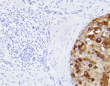 Реактив моноклональное антитело - CMM-0112 - Celnovte Biotechnology Co., Ltd. - поликлональное антитело / для исследований / ткани
