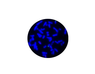 Набор для теста на брюшной тиф - CF1236 - Celnovte Biotechnology Co., Ltd. - для исследований / на раковые опухоли / для медицинских исследований