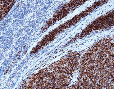 Реактив ДНК-полимераза - CTM-0132 - Celnovte Biotechnology Co., Ltd. - красящий раствор / фермент / краситель