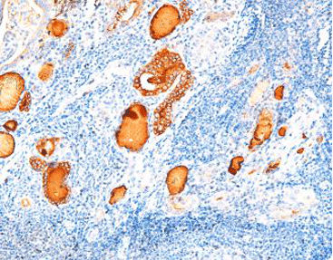 Реактив красящий раствор - CTM-0150 - Celnovte Biotechnology Co., Ltd. - антитела / краситель / ткани