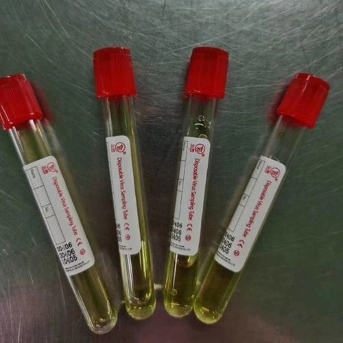 Одноразовая пробоотборная трубка - 20200006 - Cangzhou Yongkang Medical Devices Co., Ltd. - для диагностики / цилиндрическая / для носа