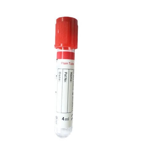 Пробоотборная трубка для диагностики - Cangzhou Yongkang Medical Devices Co., Ltd. - для иммуноанализа / цилиндрическая / крови