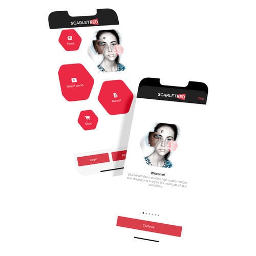 Приложение android дерматология - Scarletred®Vision - SCARLETRED Holding GmbH - для контроля / для захвата / калибровки