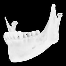 Анатомическая модель кости - Osteophoenix - челюсть / для стоматологической хирургии