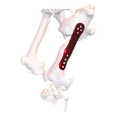 Сжимающая костная пластина для животных общего назначения - Osteophoenix