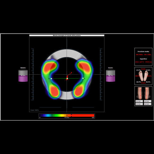 Программное обеспечение для приобретения - BioPostural System® - Microlab - для лечения заболеваний стоп / для стабилометрической платформы / для бароподометрической платформы