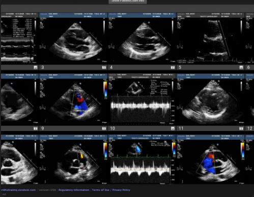 PACS для медицинских снимков - Cardiology - UltraLinq