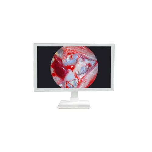 Медицинский монитор - TU-24M1080P - Shenzhen Tuyou Medical Imaging Co., Ltd.​ - для операционной / хирургический / 27"