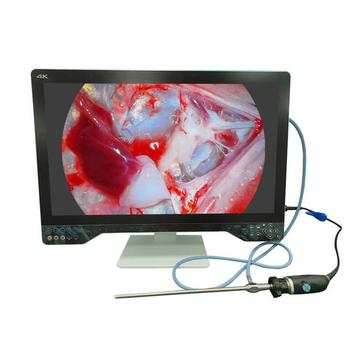 Камера для эндоскопов - TU-32LSD1A - Shenzhen Tuyou Medical Imaging Co., Ltd.​ - медицинская / хирургическая / цифровая