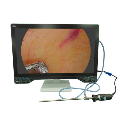 Медицинская камера - TU-32LSD1A - Shenzhen Tuyou Medical Imaging Co., Ltd.​ - хирургическая / цифровая / с высоким разрешением