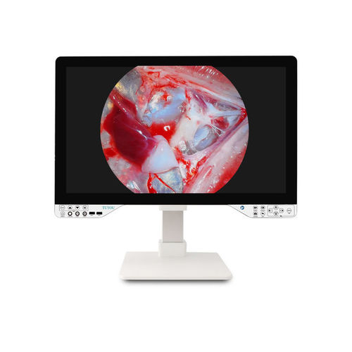 Камера для эндоскопов - TU-27LSD2B - Shenzhen Tuyou Medical Imaging Co., Ltd.​ - цифровая / VGA / с высоким разрешением