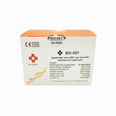 Набор для теста на инфекционные заболевания - BIK-QL-H0017 - Biokey Health - на вирус Эпштейна-Барра / сыворотки / плазменный