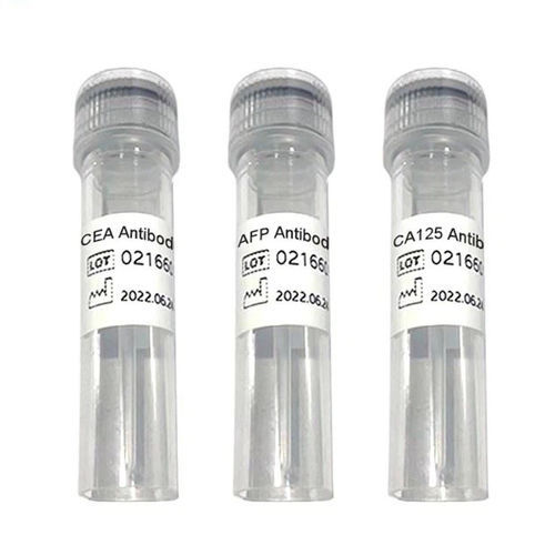 Реактив КИП - Ab100501 - Chengdu Vacure Biotechnology Co., Ltd - антитела / антиген / для диагностики