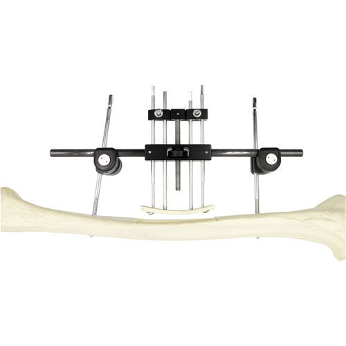 Внешний фиксатор бедренная кость - Chongqing FWS Medical Device - трубчатый