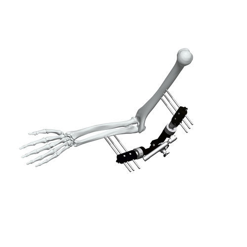 Внешний фиксатор для локтя - FE5M-D040 - Chongqing FWS Medical Device - трубчатый