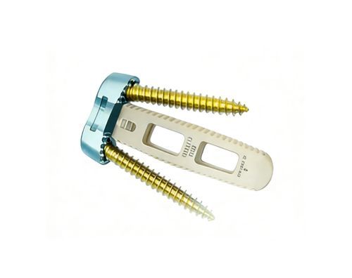 Межтеловой кейдж шеи - O-LIF - Chongqing FWS Medical Device - через передний отдел / из ПЭЭК
