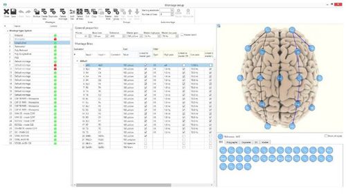 Программное обеспечение для ЭЭГ - BRAIN QUICK® - Natus Micromed - для больниц / для личных дел пациентов / для интенсивной терапии