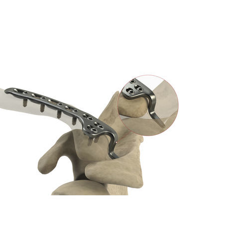Компрессионная костная пластина для ключицы - AS.SH.031 - Ases Orthopedics - дистальная / блокируемая / неблокируемая