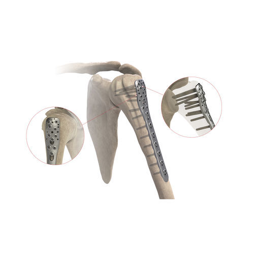 Компрессионная костная пластина плечевая кость - AS.SH.026 - Ases Orthopedics - проксимальная / боковая / блокируемая