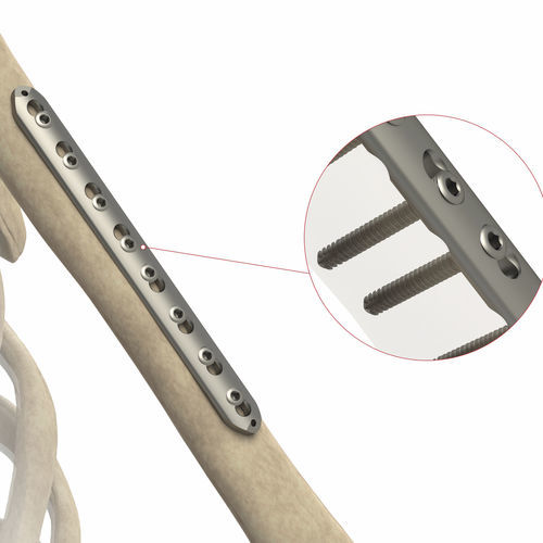 Компрессионная костная пластина лучевая кость - AS.ST.068 - Ases Orthopedics - медиальная / блокируемая / неблокируемая