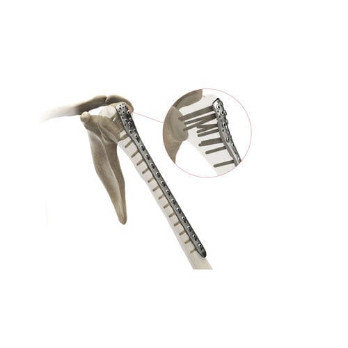 Компрессионная костная пластина плечевая кость - Ases Orthopedics - проксимальная / блокируемая