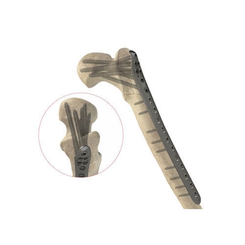 Компрессионная костная пластина бедренная кость - Ases Orthopedics - проксимальная / блокируемая