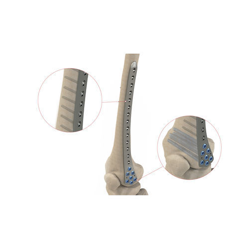 Компрессионная костная пластина для мыщелка бедренной кости - Ases Orthopedics - дистальная / блокируемая