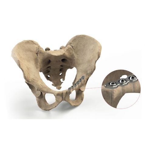 Компрессионная костная пластина таз - Ases Orthopedics - блокируемая