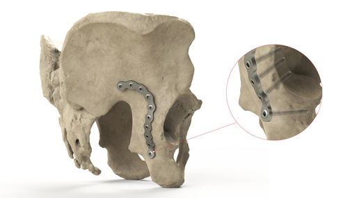 Компрессионная костная пластина таз - Ases Orthopedics - проксимальная, задняя часть